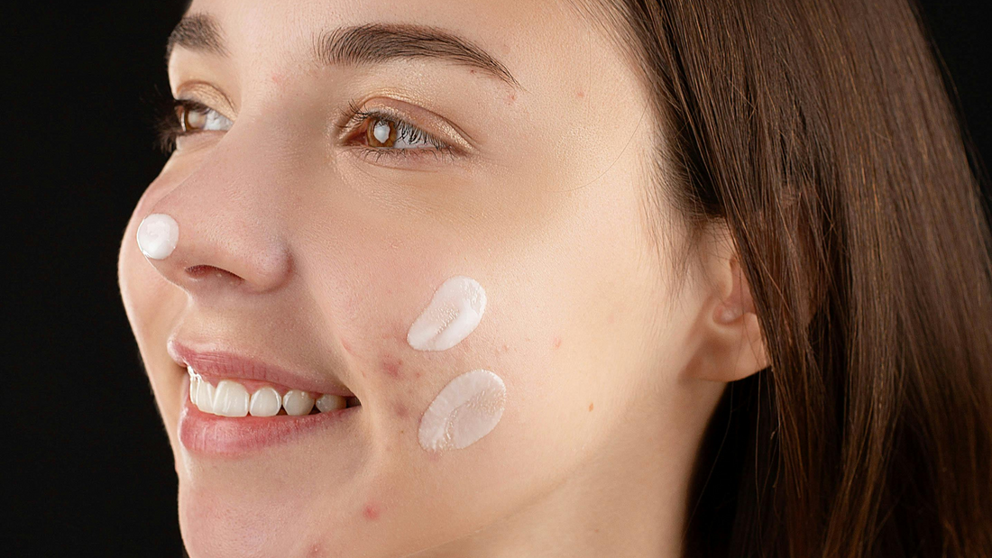 clear skin tips, acne free skin